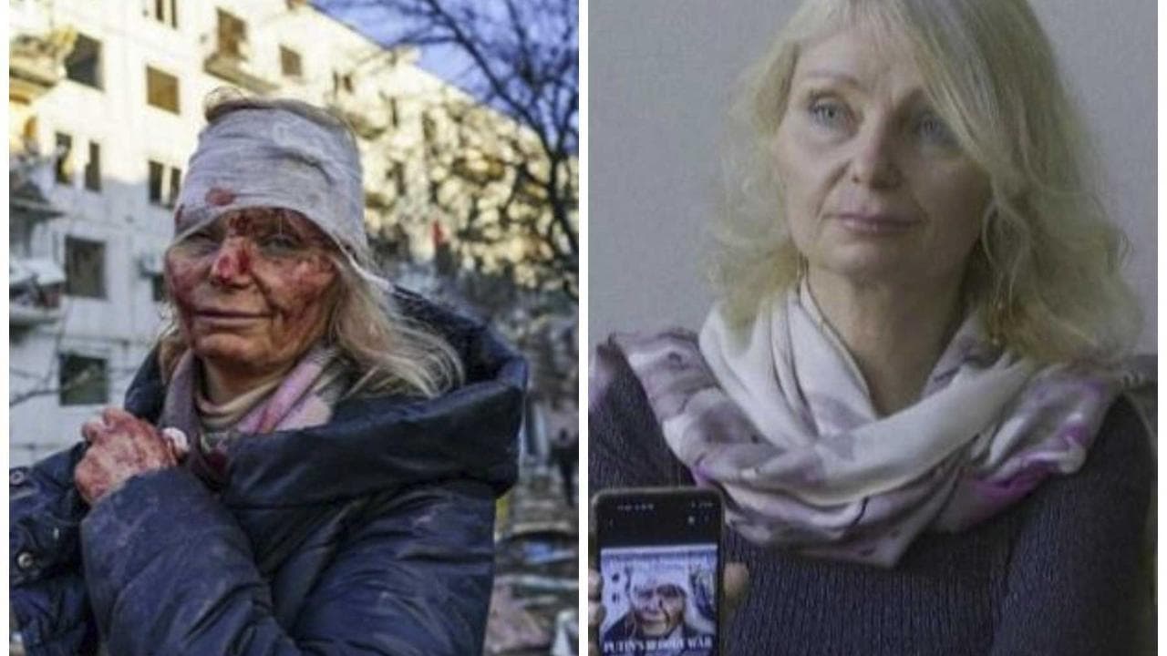 Ucraina, parla Olena Kourilo: protagonista della prima foto simbolo della guerra