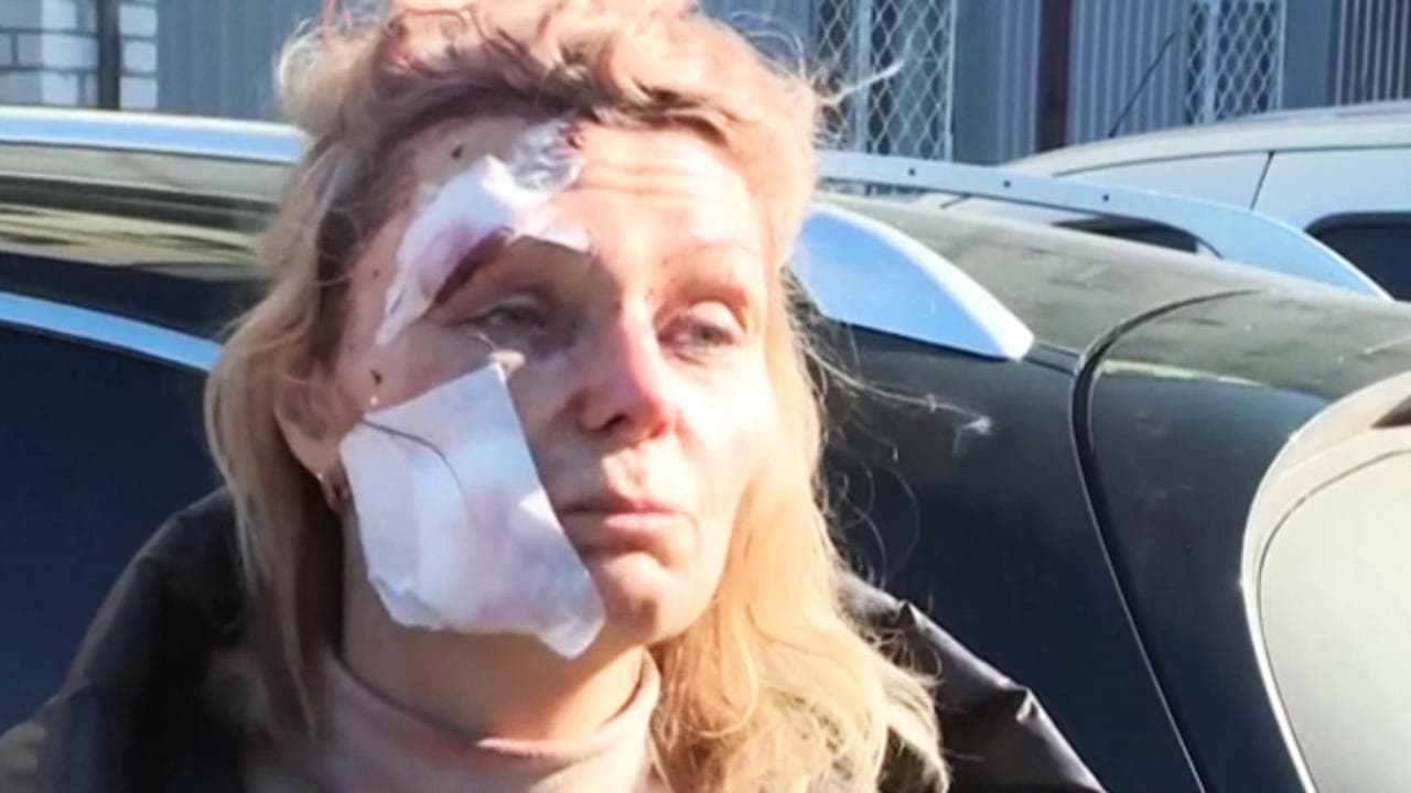 Ucraina, una cittadina di Chuguev rimasta ferita: "Casa distrutta, sono salva per miracolo"