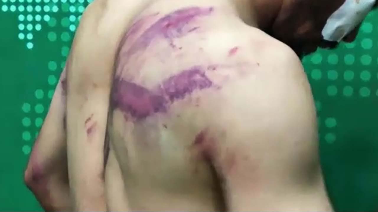 Afghanistan, due giornalisti picchiati dai talebani per aver ripreso una manifestazione: “Siamo stati torturati”