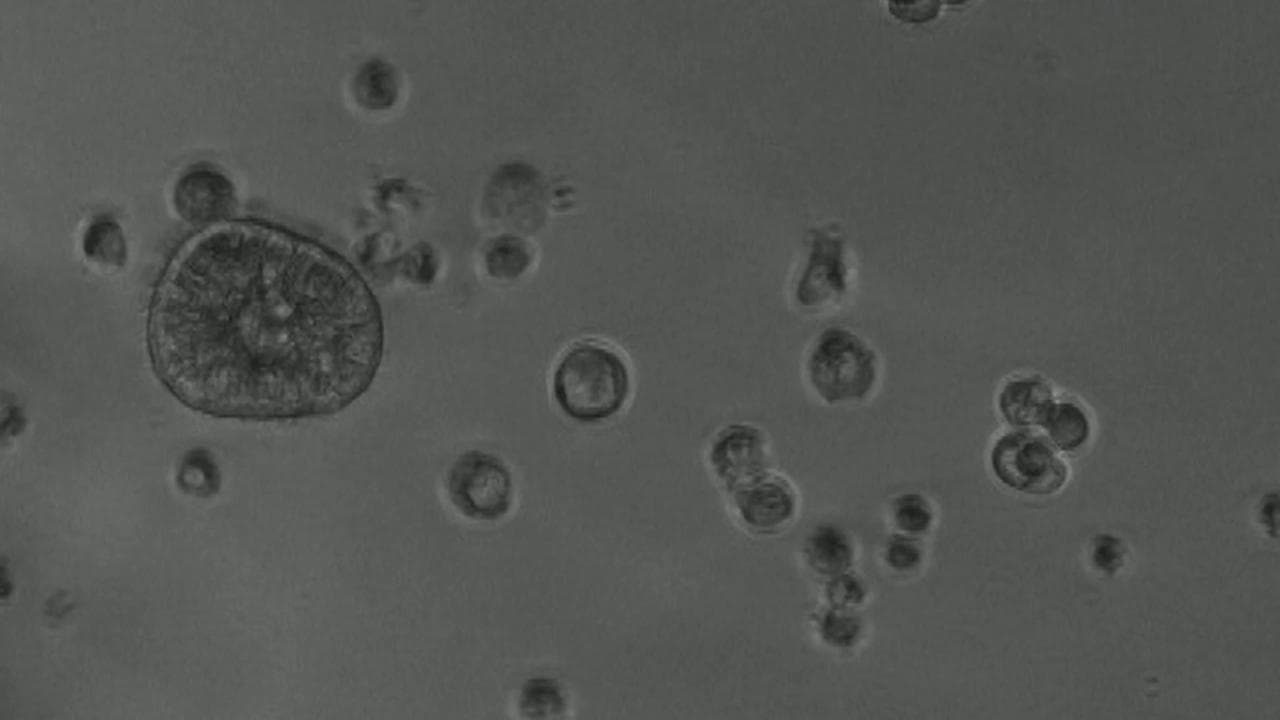 Ecco gli Anthrobot, robot biologici costruiti con cellule umane in grado di curarci dall'interno