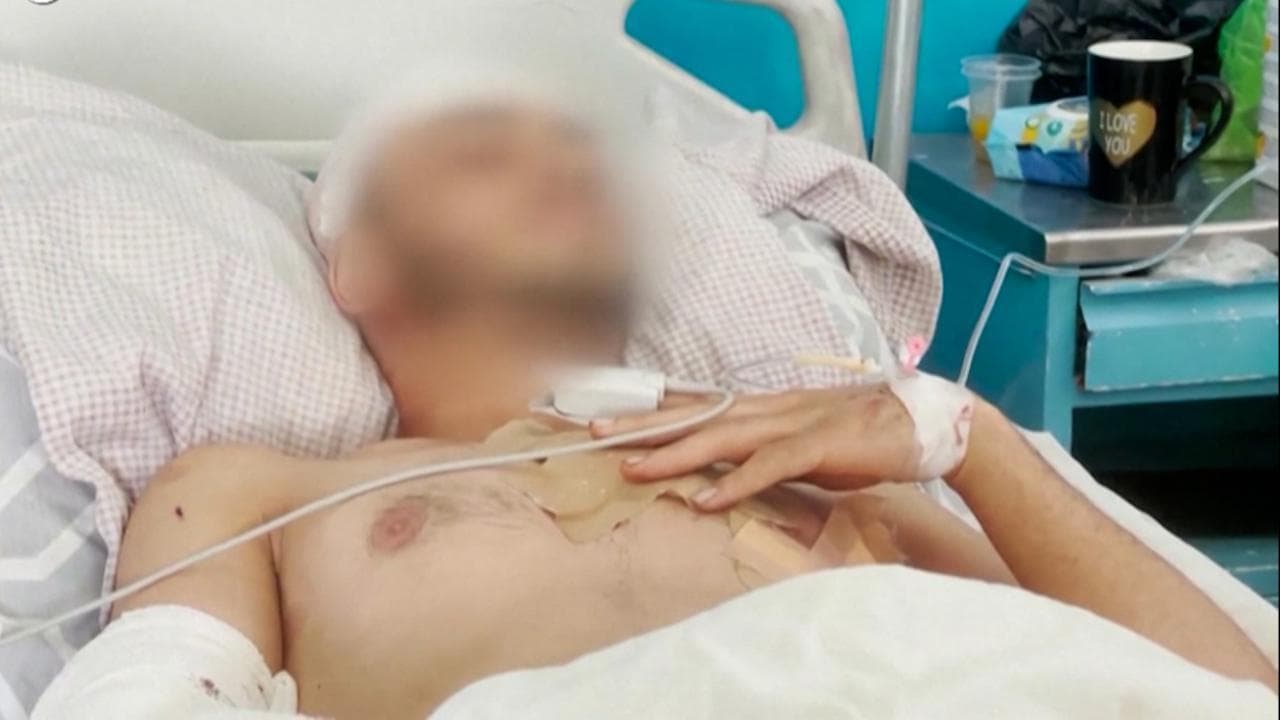 Attentato a Kabul, la testimonianza di un sopravvissuto: "Pensavo di essere l'unico ancora vivo"