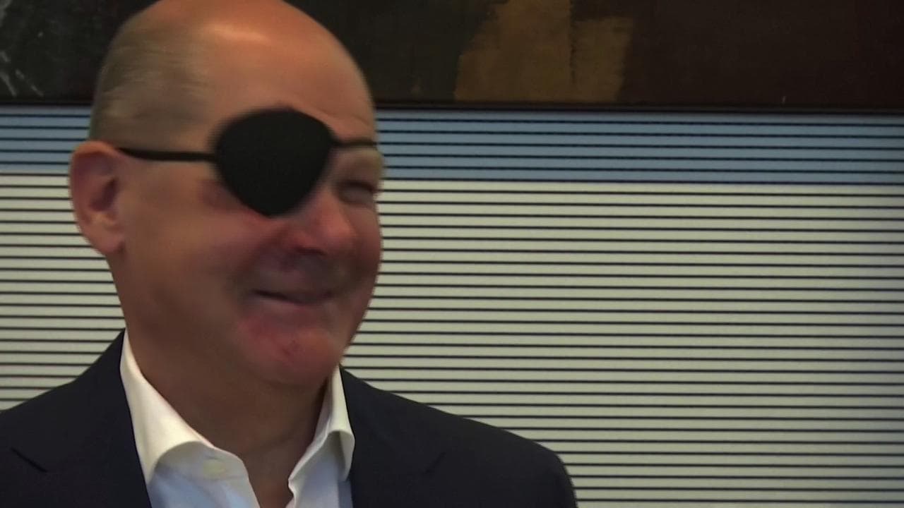 Riecco Scholz dopo la caduta, riappare in pubblico con una benda nera sull'occhio