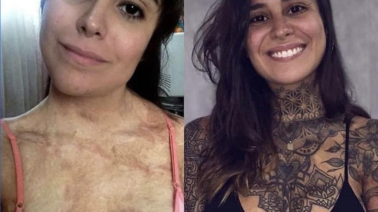 Argentina, ricopre di tatuaggi il corpo ustionato e torna a vivere