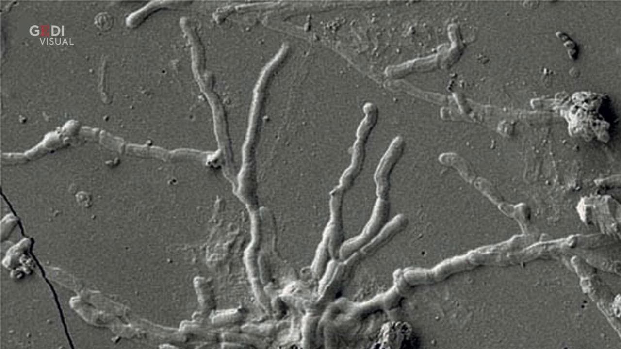 Ercolano, la scoperta: neuroni integri nel cervello di una vittima dell'eruzione