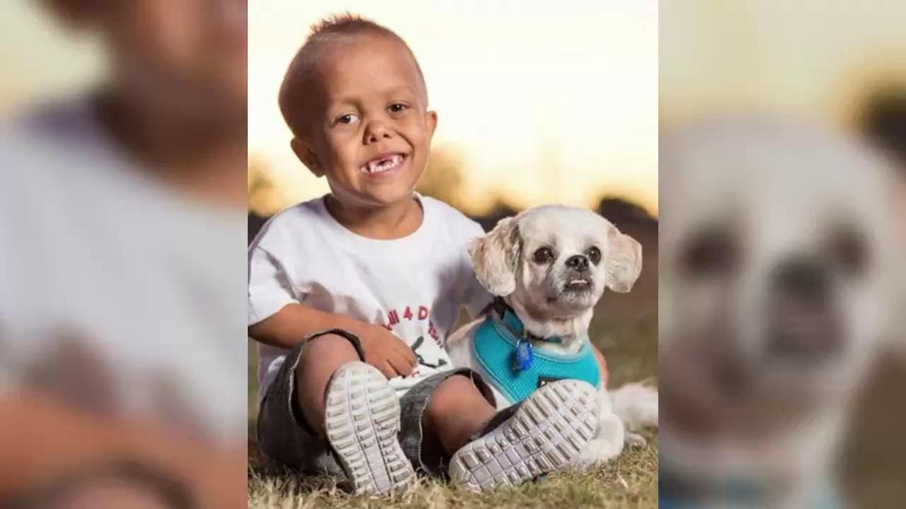 "Quaden, sei più forte di quanto pensi": il messaggio di Hugh Jackman al bimbo vessato dai bulli