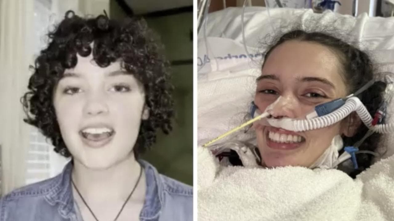 La lezione di Claire Bridges, la modella cui hanno amputato le gambe: "Non fatevi consumare dalle emozioni"