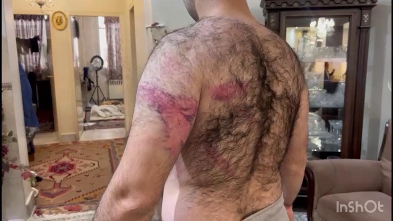 Mehdi, così lo studente di Bologna morto in Iran mostrava le ferite dopo una manifestazione. Rivolgendosi all'Italia