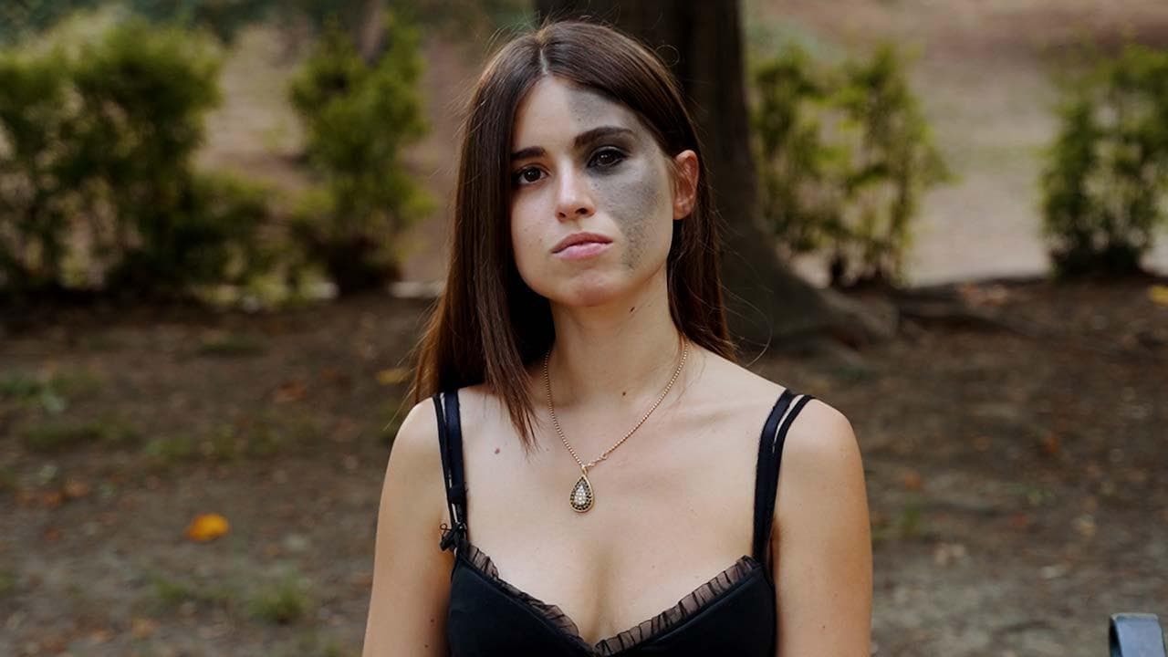 Carlotta Bertotti, la modella racconta il suo 'Nevo di Ota': "Non sentitevi soli nella diversità"