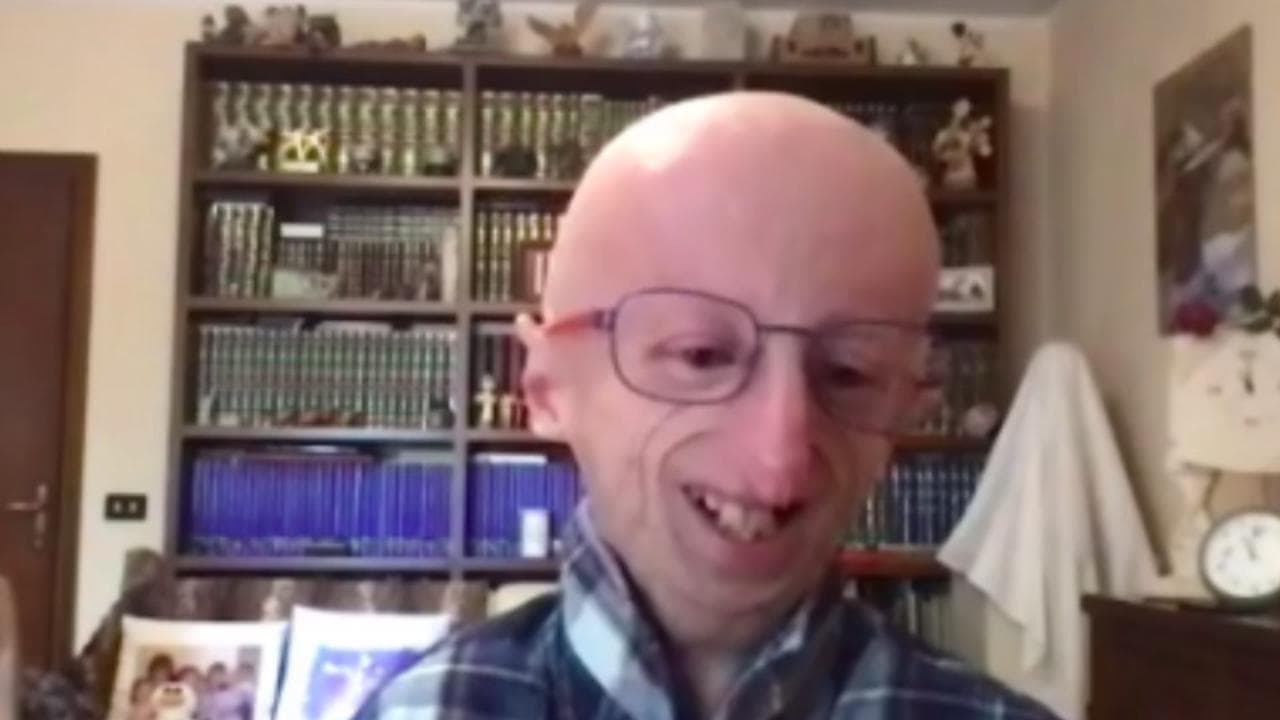 Sammy Basso, l'appello dopo il vaccino: "Affidatevi alla scienza"