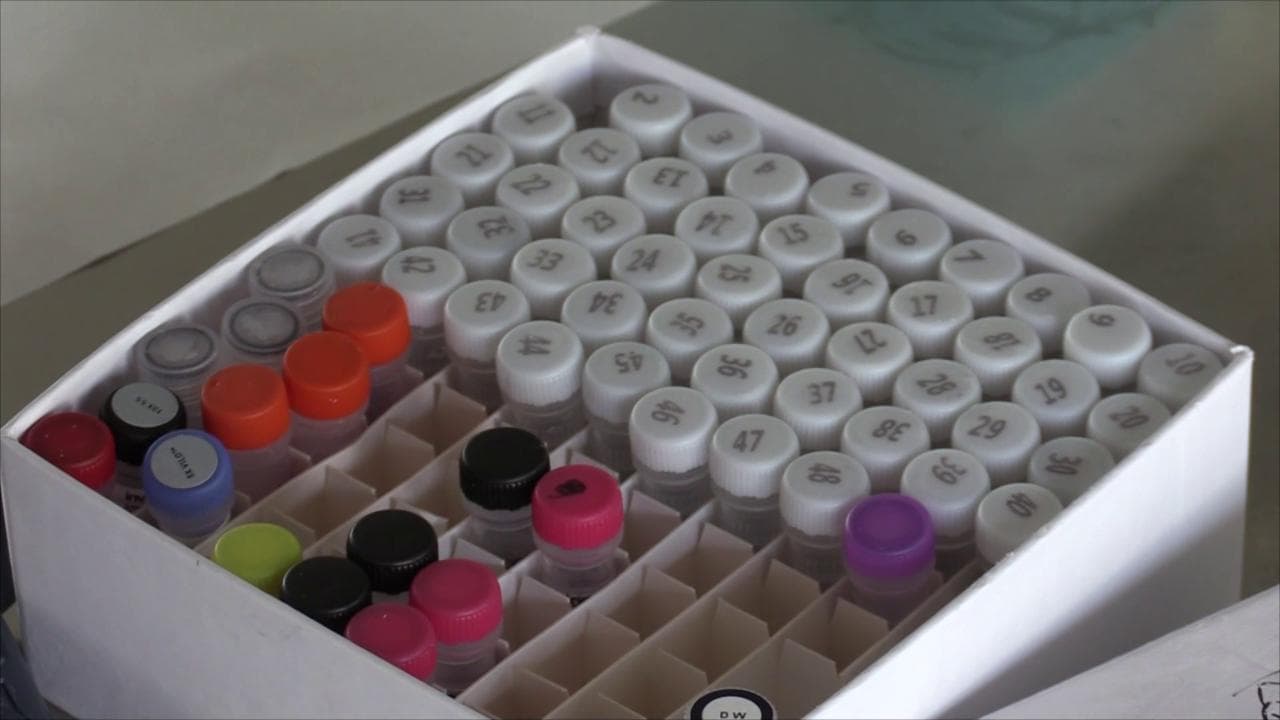 Coronavirus, in laboratorio a Roma: "Dal tampone al Dna grazie alla tecnologia: così troviamo le varianti"