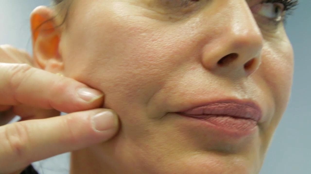 Coronavirus, così la pandemia "spinge" la chirurgia estetica: "Lo smart working in video ci fa notare di più i difetti"