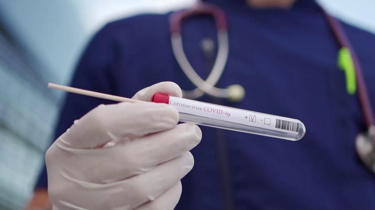 Tamponi molecolari, antigenici e sierologici: i test anti-Covid spiegati dall'esperta