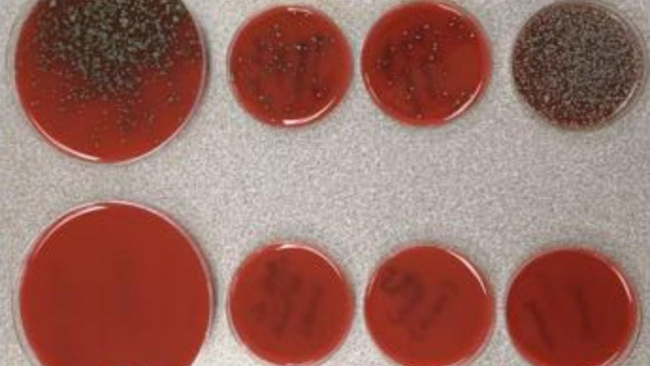 Coronavirus, il potere filtrante della mascherina: l'esperimento al microscopio