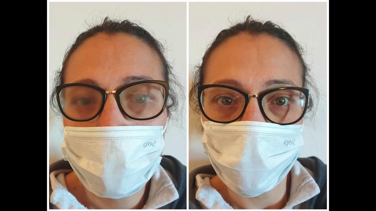 Coronavirus, come non far appannare gli occhiali quando si indossa la mascherina: i trucchi