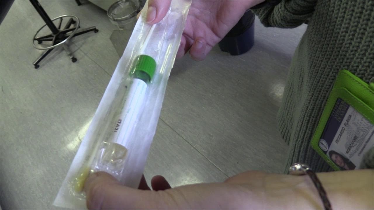 Coronavirus, cos'è un tampone e a cosa serve: così si verifica un eventuale contagio