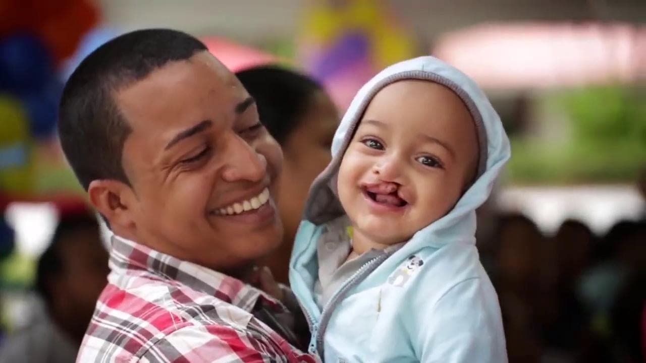 "Un sorriso globale", la campagna di Operation smile contro la labiopaltoschisi