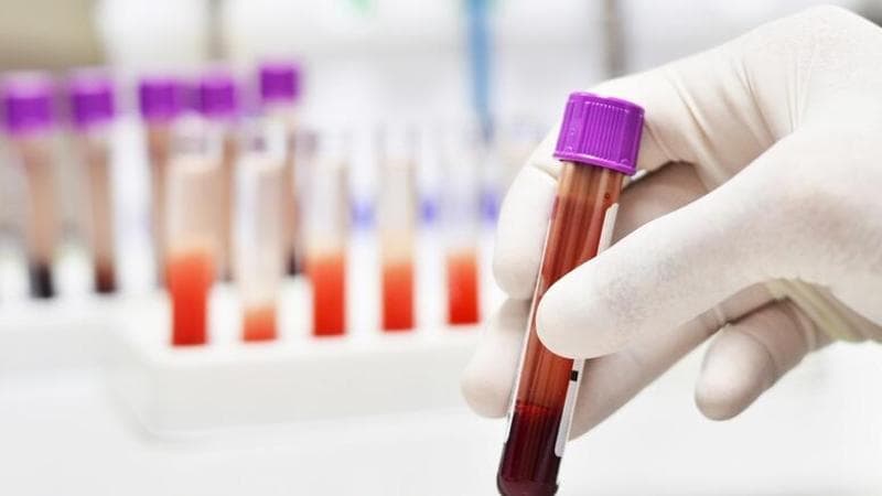 Un test del sangue per scovare il tumore del colon. Approvato per la prima volta negli Usa