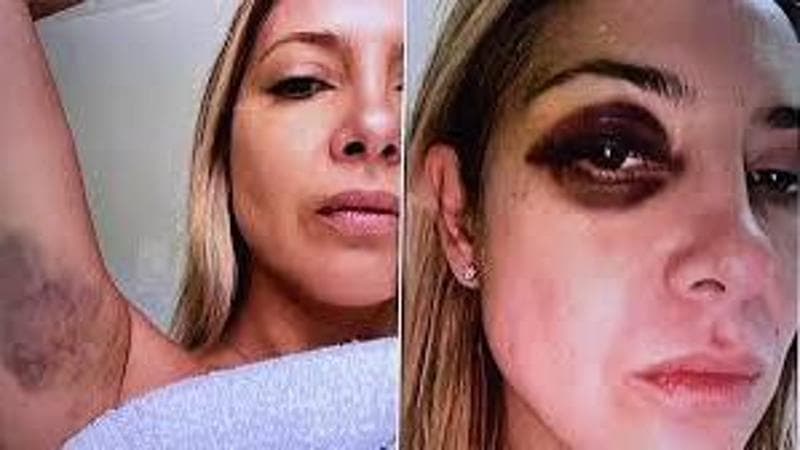 La denuncia dell’ex first lady argentina Fabiola Yañez contro il marito Alberto Fernandez: violenza domestica e molestie