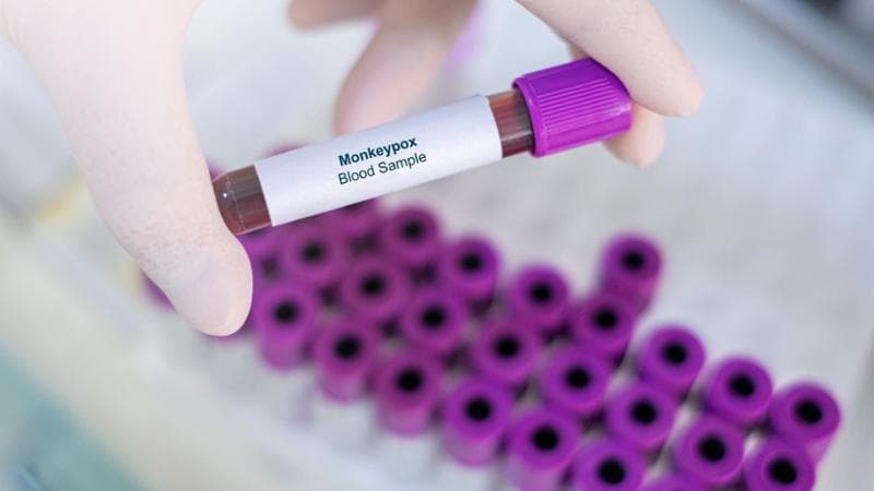 Mpox, nuova variante più virulenta in Africa. L’Oms: “Rischio serio di diffusione nel resto del mondo”