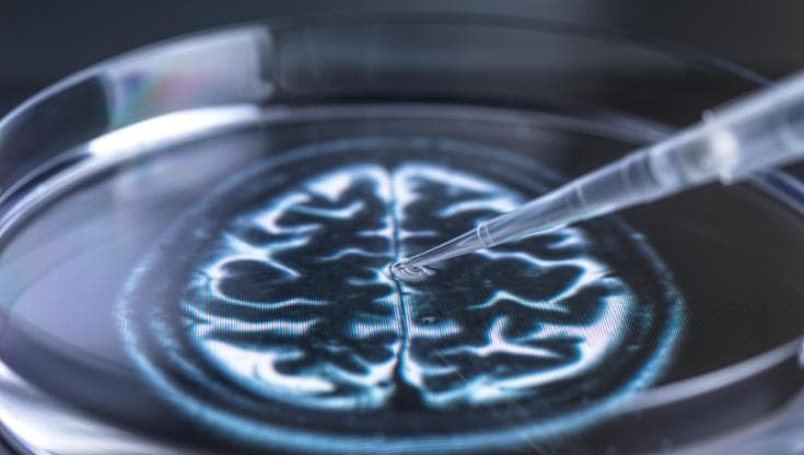 Depressione, una piccola stimolazione elettrica al cervello può curarla
