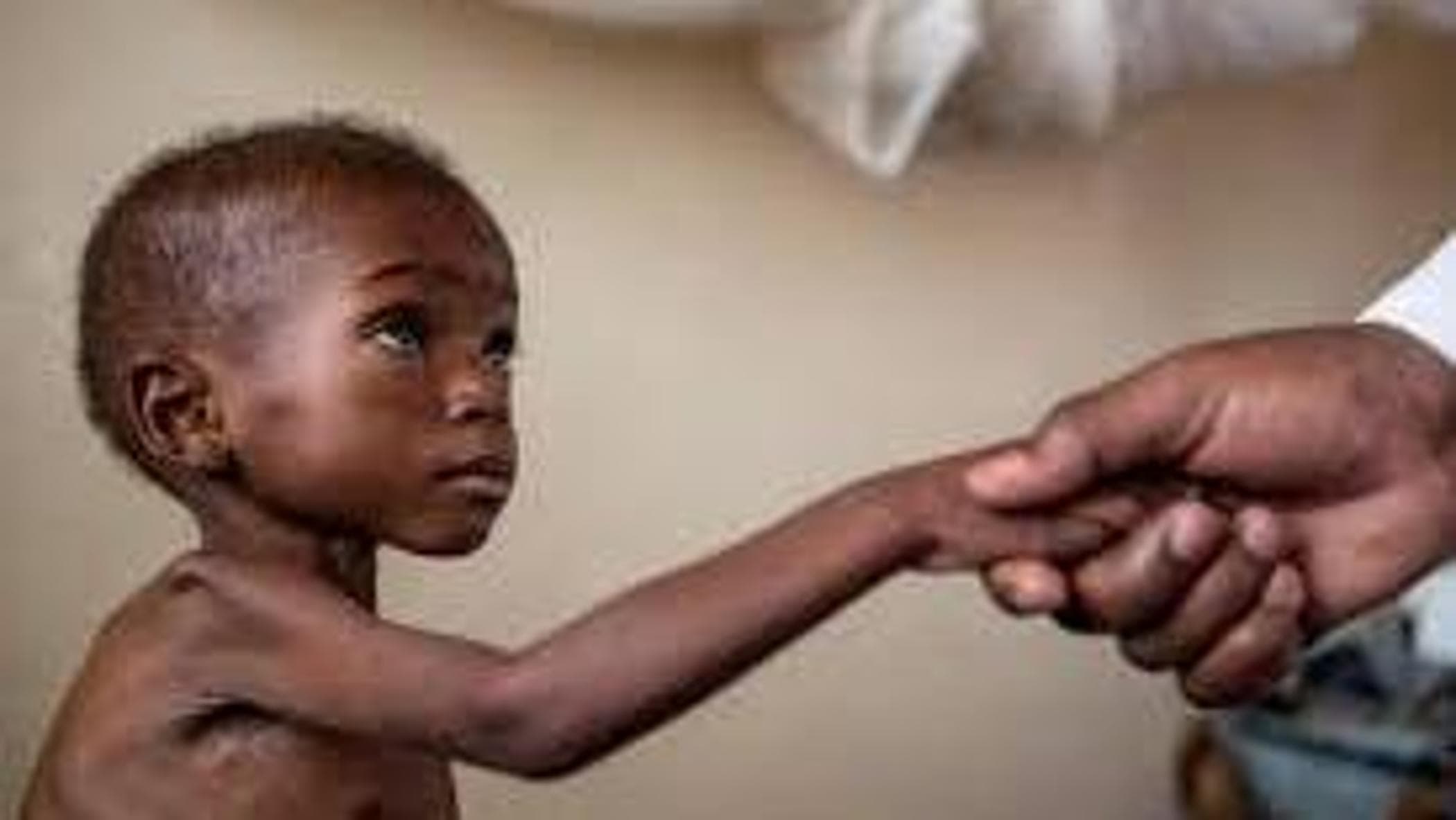 Bebek ölümleri, 1.800.000 Afrikalı çocuk HIV'den etkileniyor: En çok etkilenen bölge, küresel HIV pozitif çocukların %90'ının tek başına bulunduğu Sahraaltı bölgesidir.
