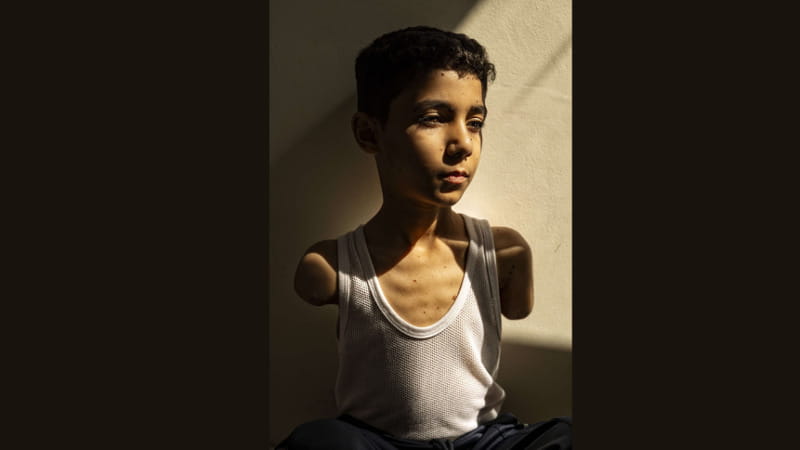 Mahmoud Ajjour, 9 anni. Foto di Samar Abu Elouf