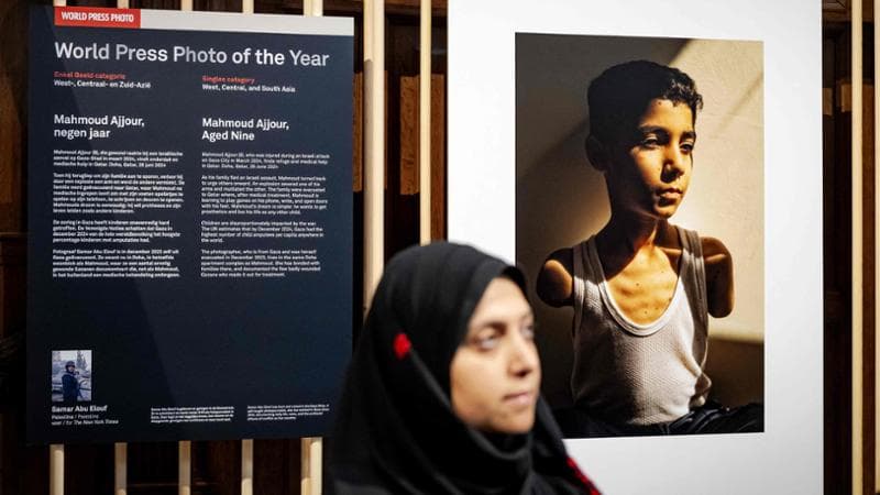 Diario da Gaza: “Qui nella Striscia, i bambini senza braccia del World Press Photo sono dovunque”