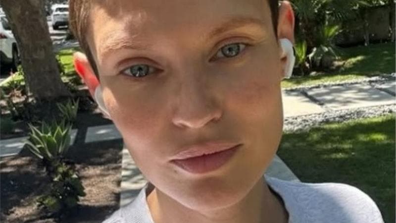 Bianca Balti, il cancro e le industrie farmaceutiche: “Senza pillole salvavita non posso lavorare”
