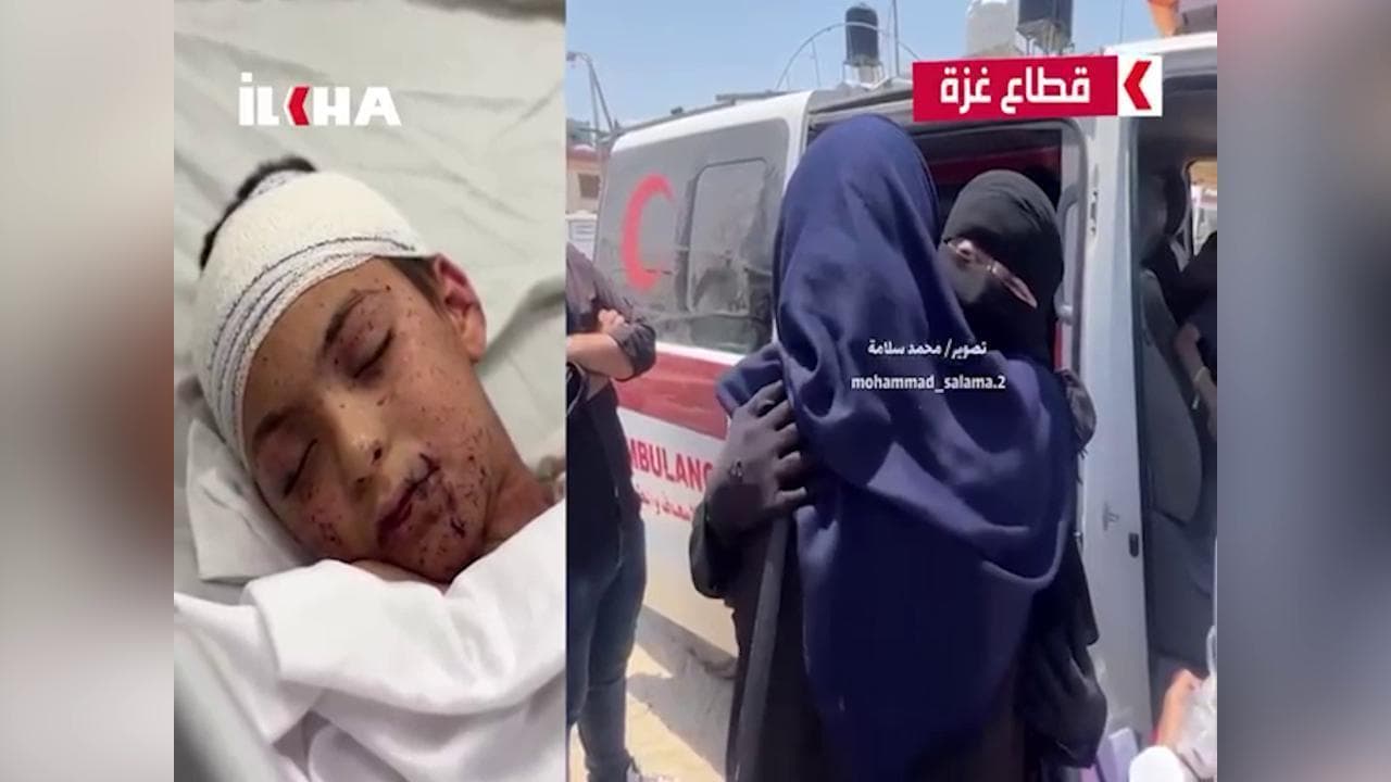 Il piccolo Adam lascia Gaza: le immagini della partenza per l'Italia del bimbo superstite