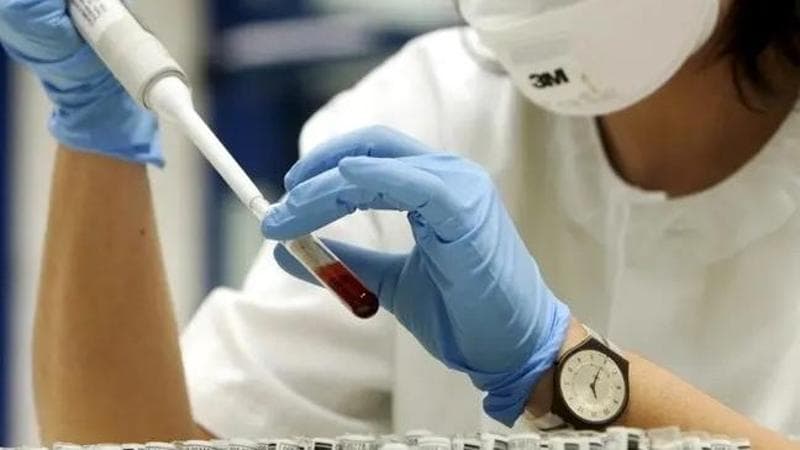 Dai sintomi del botulino a cosa fare: il decalogo per evitare l'intossicazione