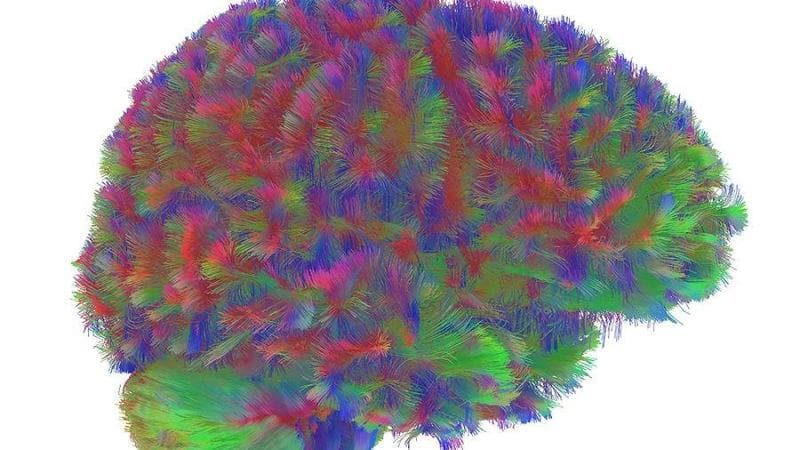 Le connessioni di un cervello bambino. Dr Alexa Mousley, University of Cambridge