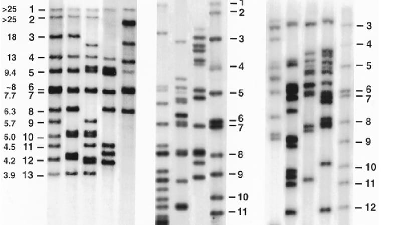 Garlasco, il genetista Novelli sul Dna: “Ecco perché l’esame è importante e che risposte fornisce”