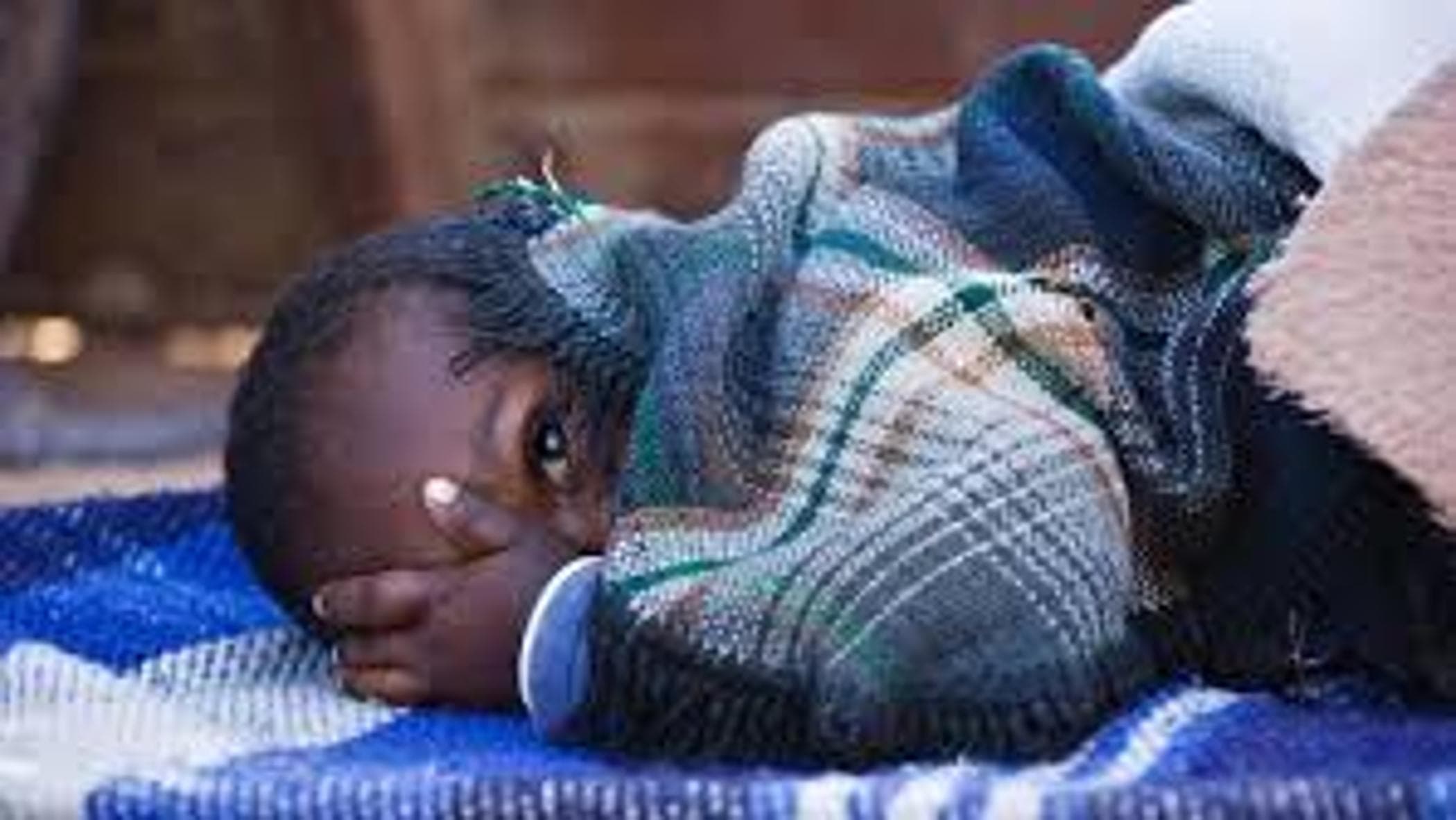 İhmal edilen hastalıklar, yoksulluğun sembolü: 172 bin yeni vaka, en çok etkilenenler arasında çocuklar ve kadınlar var