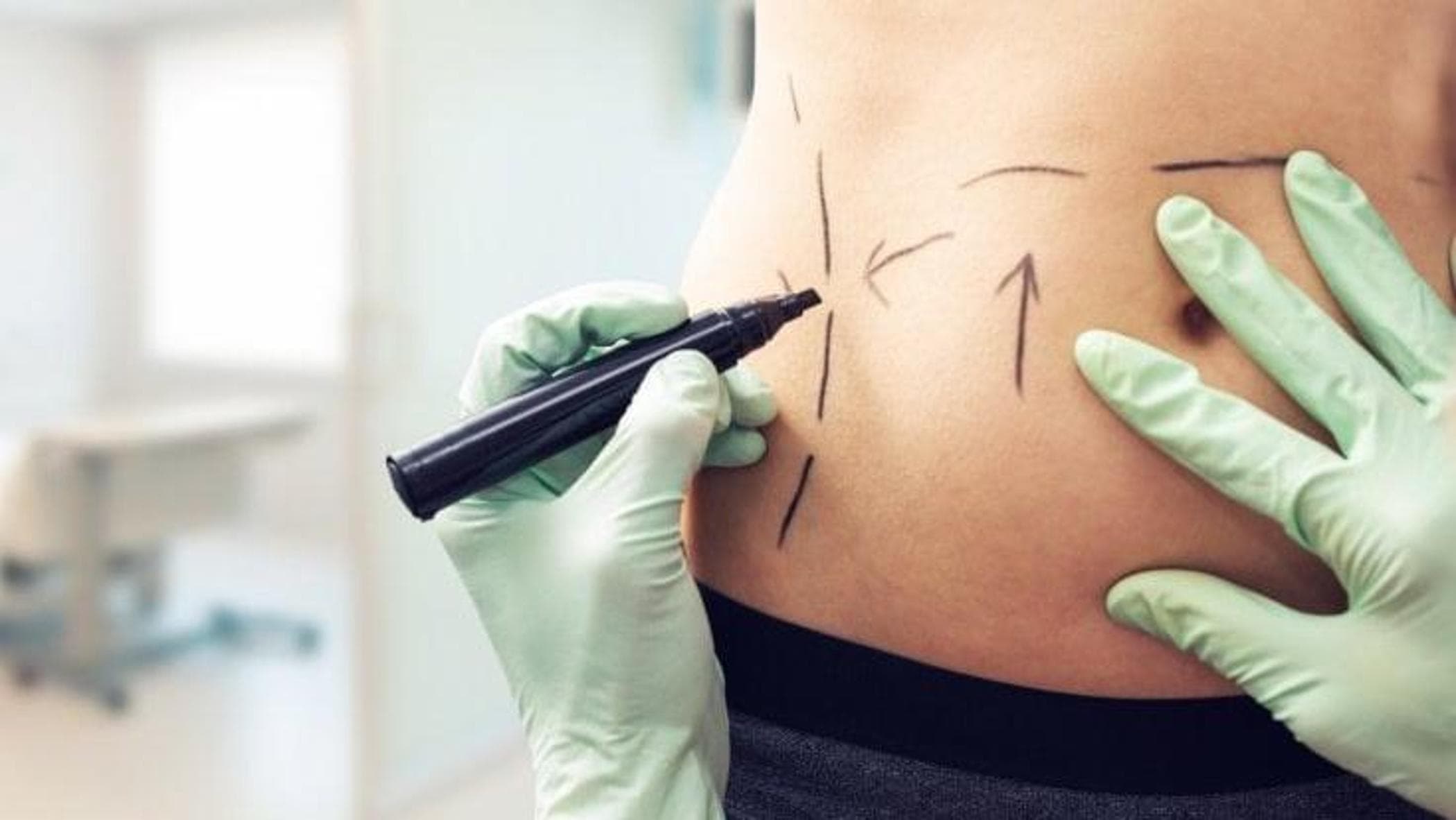 Cina, guerra ai chirurghi estetici: “Basta con gli spot sul web e le cliniche fuori controllo”