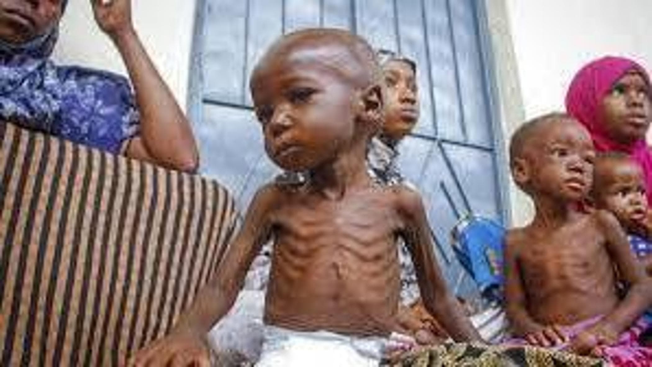 Bebek ölümü: Her yıl 5 milyon çocuk 5 yaşına gelmeden ölüyor