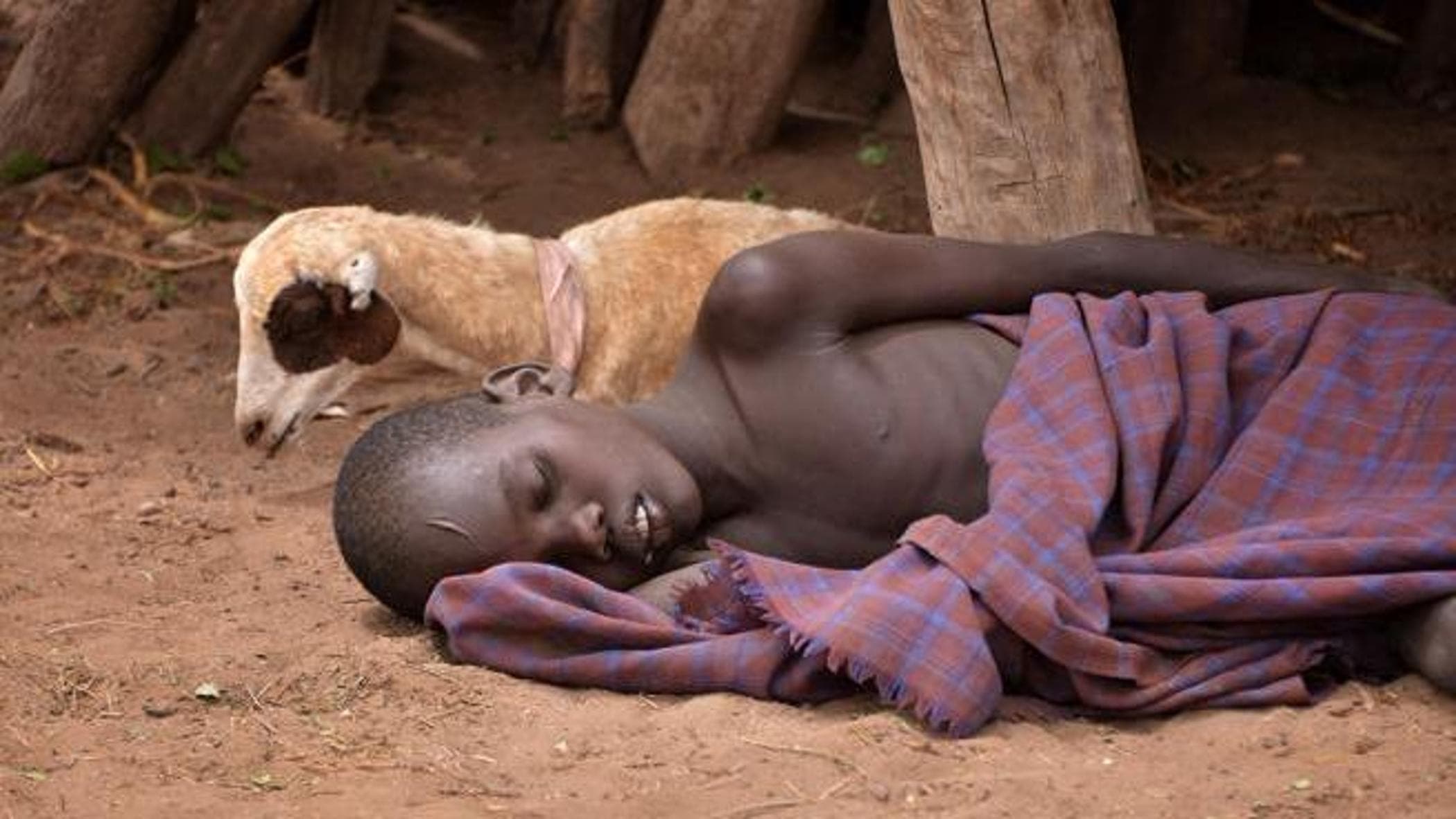 Sıtma, son 26 yılda 2,3 milyar vaka ve 14 milyon ölüm: %95'i yalnızca Afrika'da