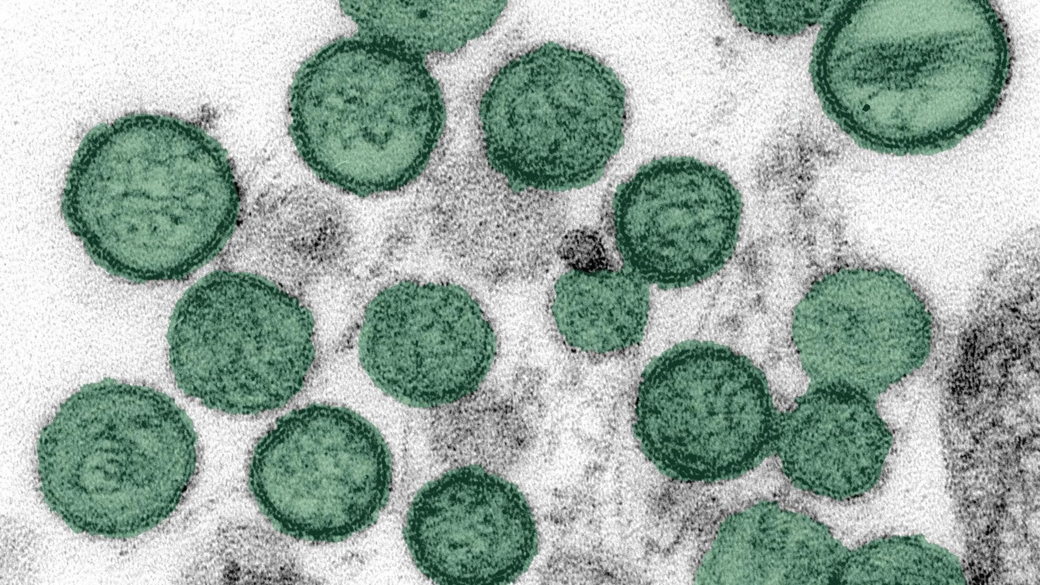 roditori contagio virus
