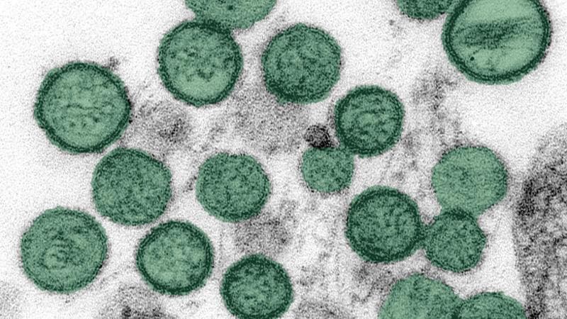 Nuovo caso di hantavirus a bordo della nave Hondius. Tre persone malate evacuate tramite un volo sanitario.4