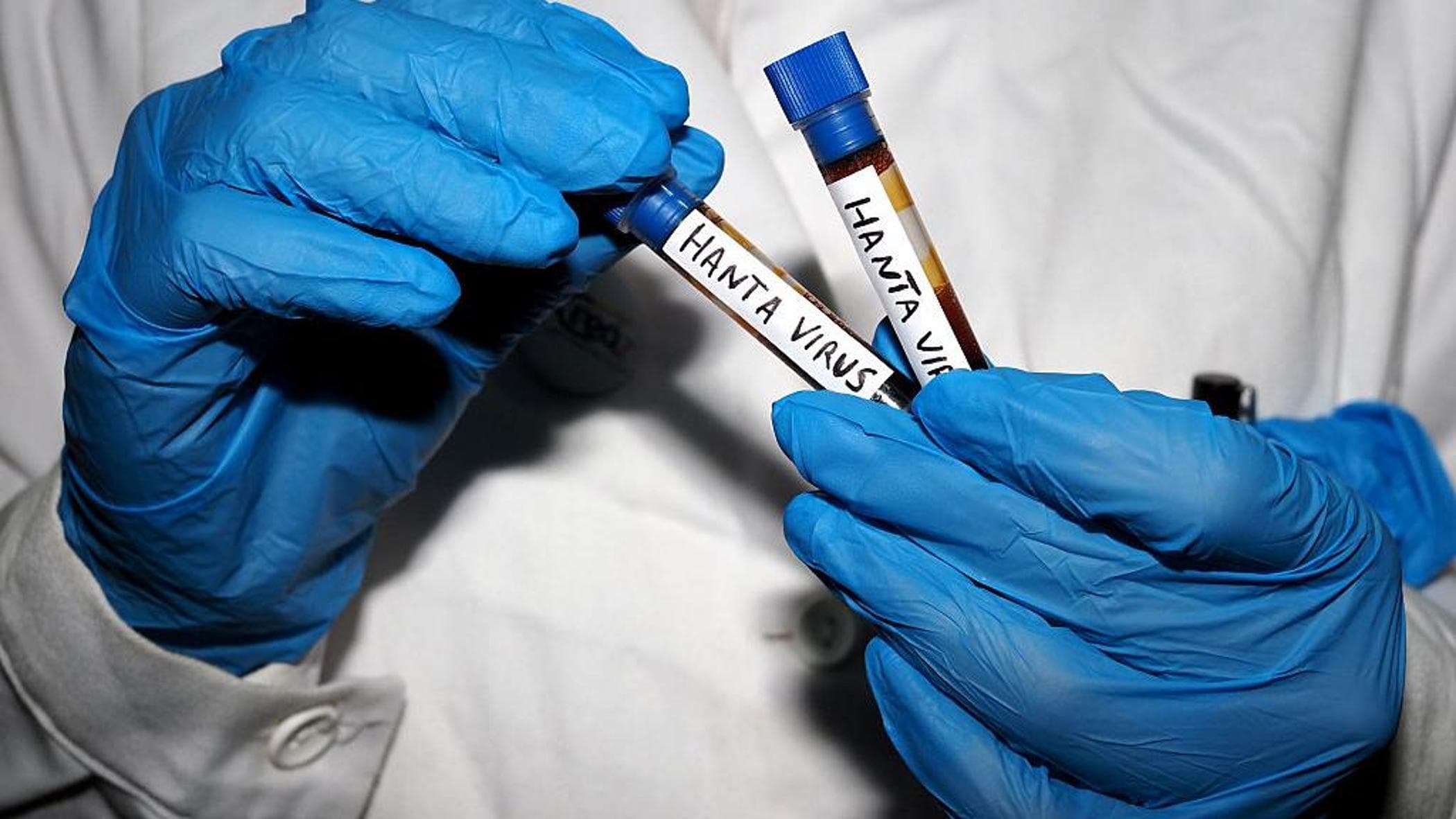 Hantavirus, professore sudafricano isolato a Padova: anche se è negativo non tornerà nel suo Paese