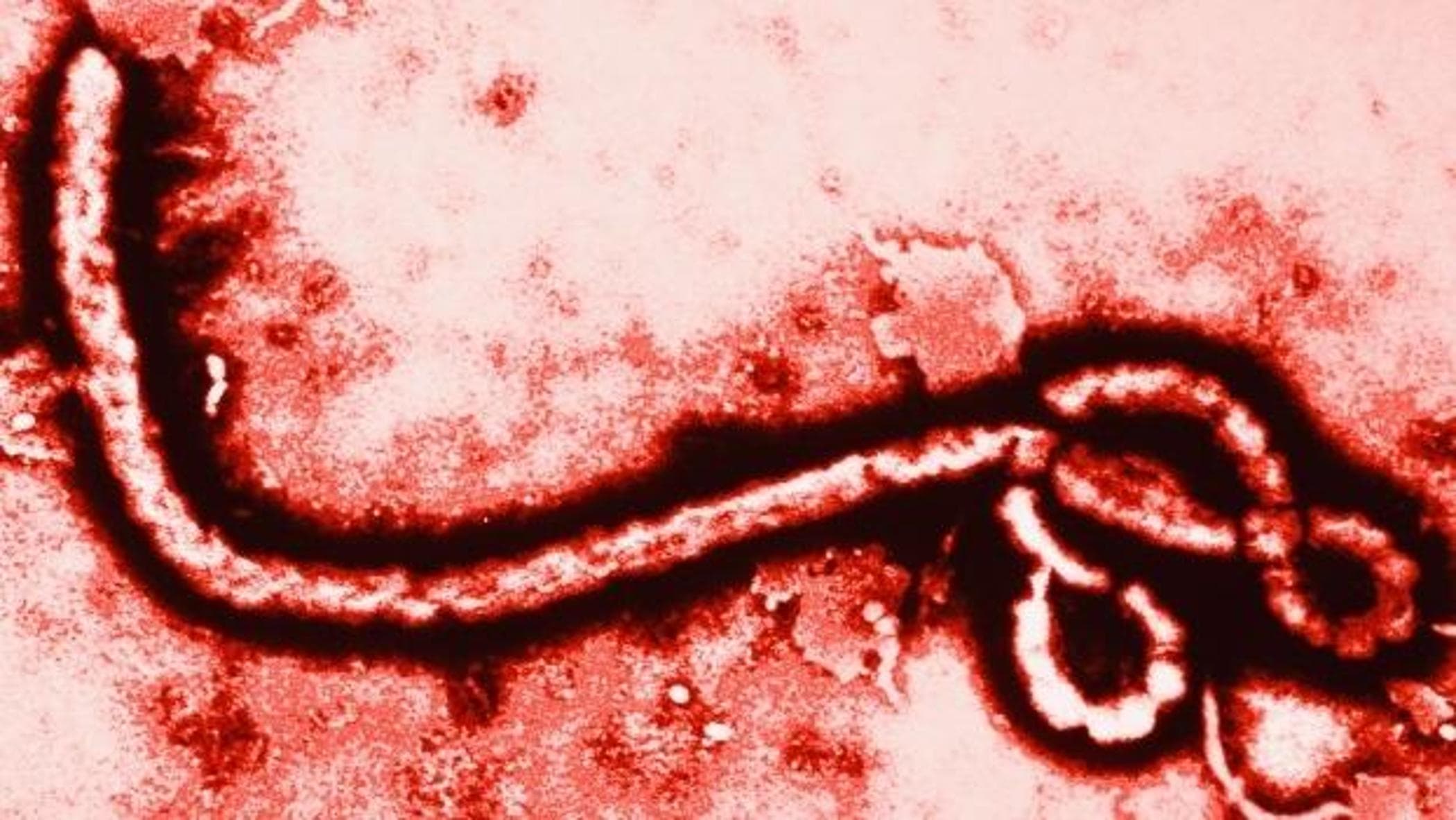 Sospetto Ebola, test a Cagliari su un paziente rientrato dall’estero