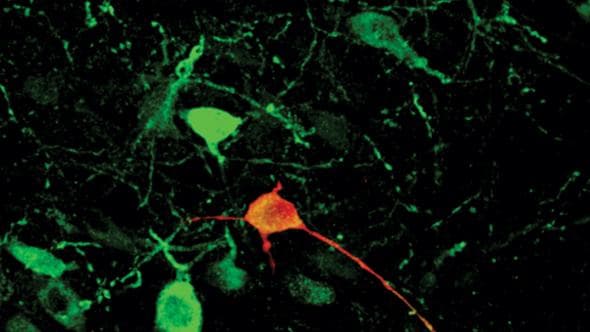 Uno studio ha scoperto come il cervello innesca le risposte in base a contesti diversi