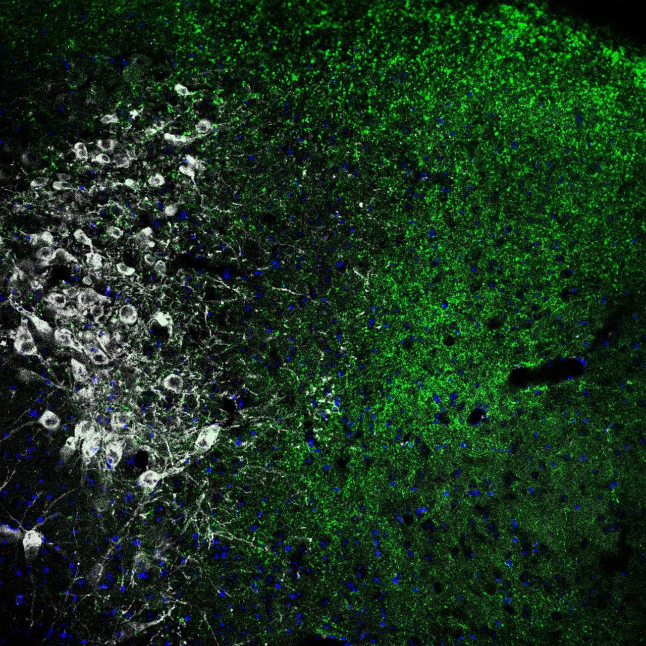 Neuroni del Locus Coeruleus visti al microscopio a fluorescenza - Istituto Italiano di Tecnologia - © IIT, all rights reserved