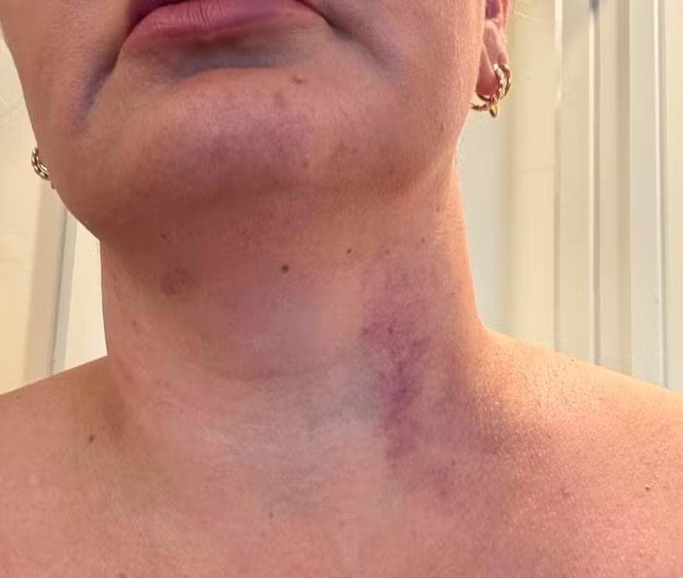 Una delle foto che la donna brasiliana ha allegato alla sua denuncia