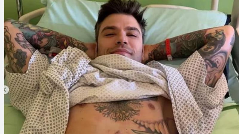La contestata foto della cicatrice pubblicata da Fedez dopo l'operazione subita nel 2023