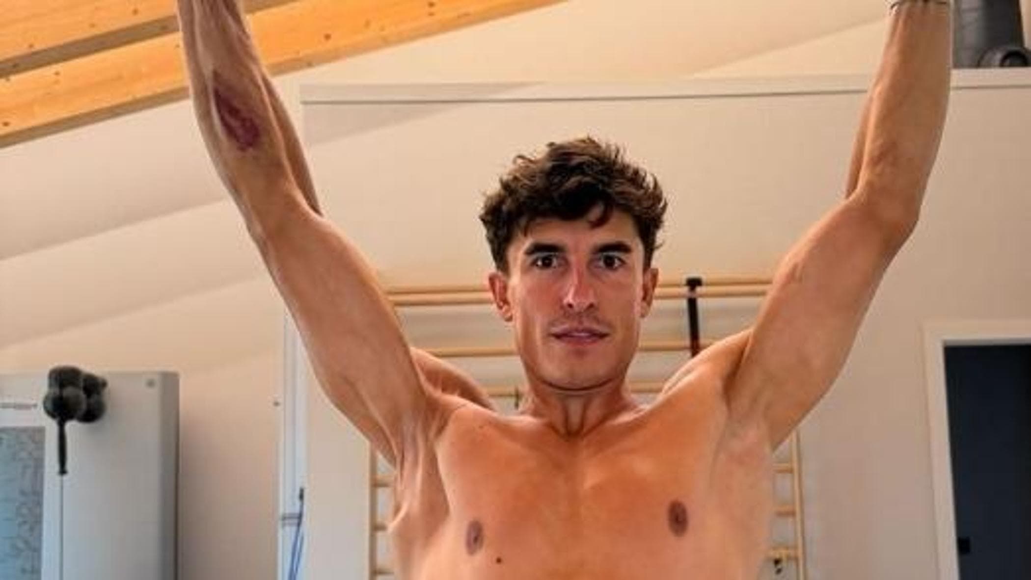marc marquez e l8217impressionante foto del braccio operato sette volte che ha rischiato di perdere da Repubblica.it marc marquez e l8217impressionante foto del braccio operato sette volte che ha rischiato di perdere