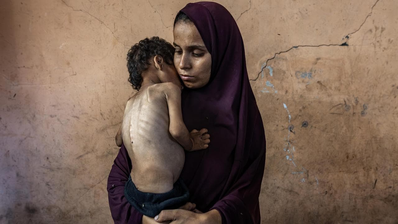 Yazan Abu Foul, un bambino di due anni, soffre di grave malnutrizione. Lui e la sua famiglia vivono tra le macerie della loro casa distrutta nel campo profughi di Al-Shati, a ovest di Gaza City. Sua madre, Naima Abu Foul, ha 30 anni e quattro figli; è incinta del quinto
© Saher Alghorra