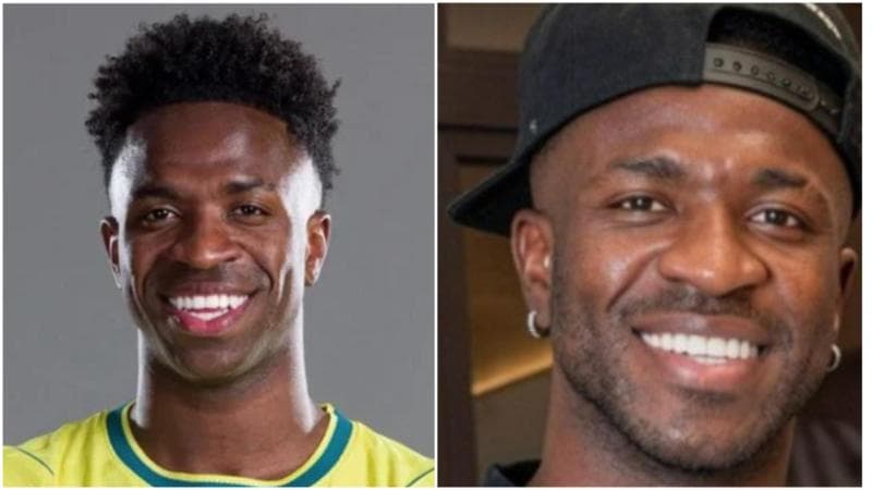 Vinicius prima e dopo l'operazione