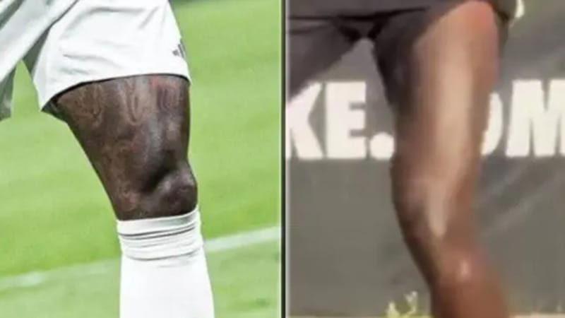 La coscia di Vinicius con e senza tatuaggi