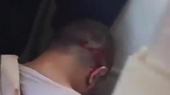 Flydubai, l'attentatore in ginocchio con i polsi legati e la camicia sporca di sangue