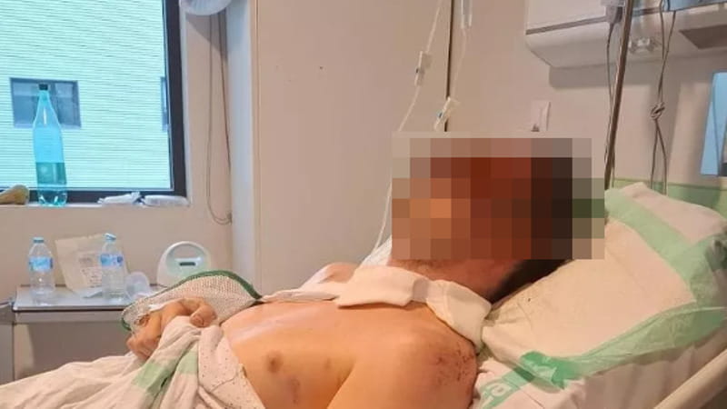 L’italiano sopravvissuto: “Ero vicino a mia sorella, temo che lei sia morta”